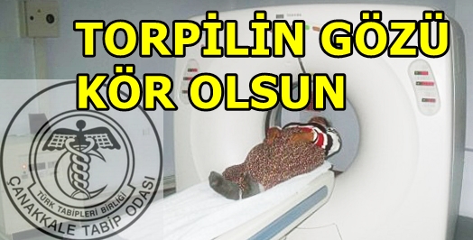 Torpilin gözü kör olsun