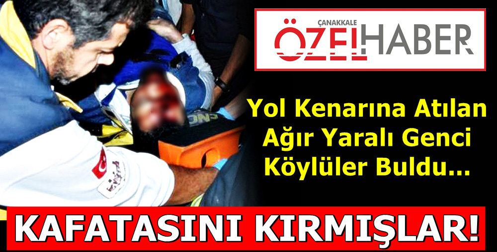 HAYATINDAN ENDİŞE EDİLİYOR..!