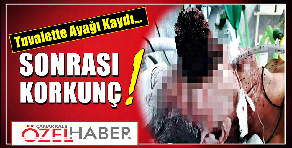 OK GİBİ SAPLANDI..!