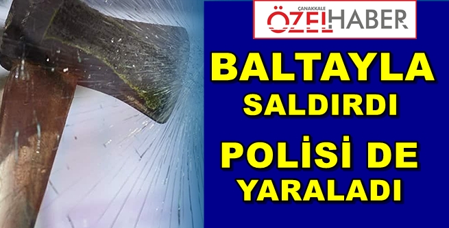 BALTALI BIÇAKLI KAVGA HEM DE ÇANAKKALE’DE!