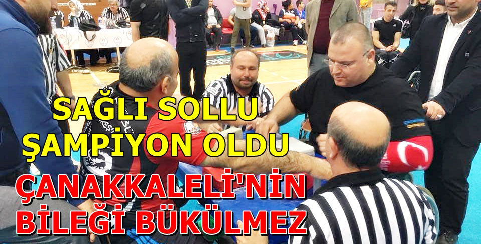 BİLEĞİ BÜKÜLMÜYOR