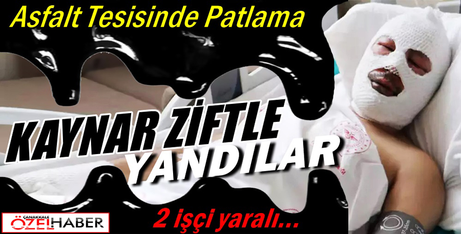 ÖZEL İDARE TESİSİNDE KORKUNÇ KAZA..!