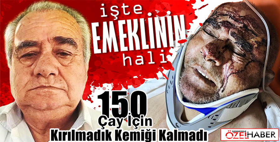 VERESİYE BORCU YÜZÜNDEN ÖLÜYORDU..!